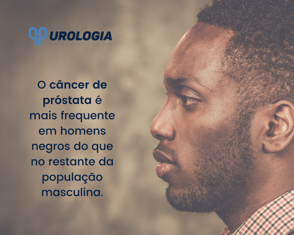 HOMEM NEGRO: ATENÇÃO REDOBRADA AO CÂNCER DE PRÓSTATA – Urologista |  Instituto de Urologia Mato Grosso do Sul | Campo Grande MS